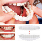 Facetas dentárias clip-on superiores e inferiores em silicone de grau médico