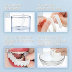 Facetas dentárias clip-on superiores e inferiores em silicone de grau médico