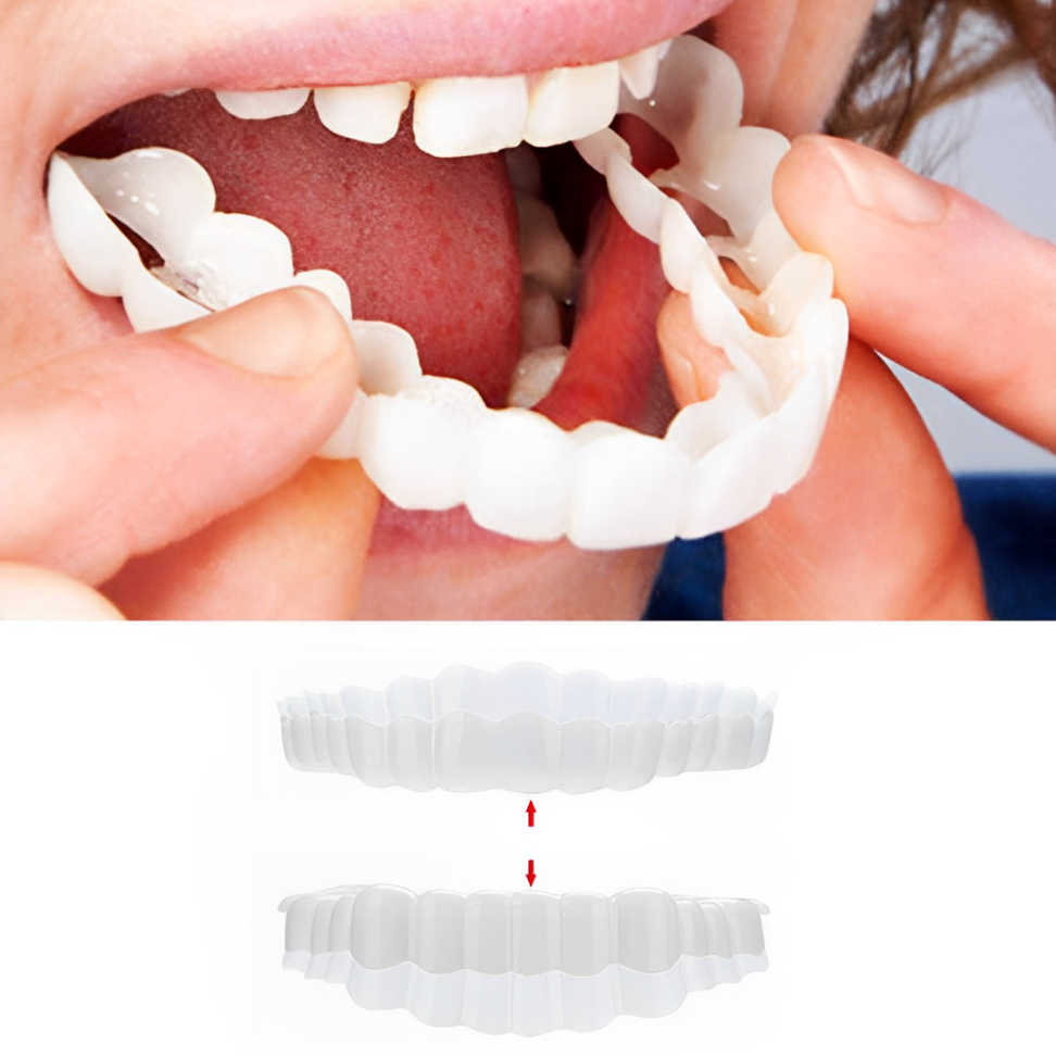 Facetas dentárias clip-on superiores e inferiores em silicone de grau médico