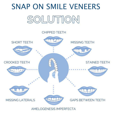 Facetas dentárias clip-on superiores e inferiores em silicone de grau médico